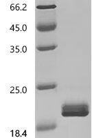 Human Chromogranin-A (CHGA), partial Recombinant Protein, C-10His, aa 19–144 - BioCrest Sci