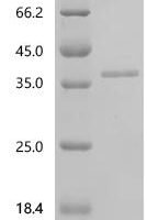 Human Leucine-rich repeat-containing protein 9 (LRRC9), partial Recombinant Protein - BioCrest Sci