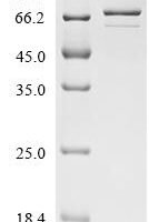 Corylus avellana 11S globulin-like protein Recombinant Protein - BioCrest Sci