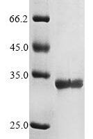 Human herpesvirus 6B mRNA export factor ICP27 homolog (KA3L), partial Recombinant Protein - BioCrest Sci