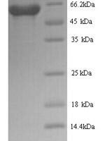 Rabies virus Glycoprotein (G), partial Recombinant Protein, N-His - BioCrest Sci
