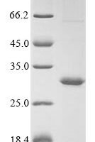 Epstein-Barr virus Glycoprotein BDLF3 (BDLF3), partial Recombinant Protein - BioCrest Sci