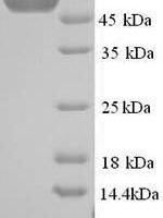 Human E3 ubiquitin-protein ligase MYLIP (MYLIP) Recombinant Protein, N-His - BioCrest Sci