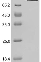 Human Amyloid-beta precursor protein (APP), partial Recombinant Protein, C-10His - BioCrest Sci