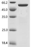 Human Aryl-hydrocarbon-interacting protein-like 1 (AIPL1) Recombinant Protein, C-His - BioCrest Sci