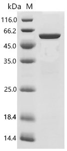 Human Aryl-hydrocarbon-interacting protein-like 1 (AIPL1) Recombinant Protein, C-His, E.coli, C-terminal 6xHis-tagged, 50.8 kDa, purity >≥ 90% as determined by SDS-PAGE.
