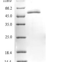 Pseudomonas azotoformans L-amino acid amidase (laaA) Recombinant Protein - BioCrest Sci