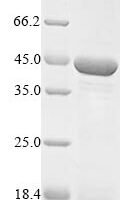 Human Mitochondrial fission factor (MFF), partial Recombinant Protein - BioCrest Sci