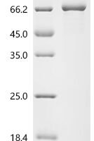 Human Acetylcholinesterase (ACHE) Recombinant Protein, C-His - BioCrest Sci