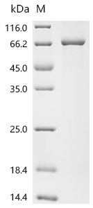 Human Acetylcholinesterase (ACHE) Recombinant Protein, C-His, Homo sapiens (Human), E.coli, C-terminal 6xHis-tagged, 71.5 kDa, purity >≥ 90% as determined by SDS-PAGE.