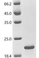 Flock house virus Protein B2 (B2) Recombinant Protein - BioCrest Sci