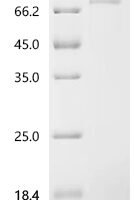 Mouse Protein NDNF (Ndnf) Recombinant Protein, C-10His - BioCrest Sci