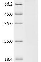 Human Suppressor of cytokine signaling 6 (SOCS6) Recombinant Protein, C-His - BioCrest Sci