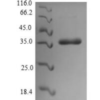 Escherichia coli CS6 fimbrial subunit B (cssB) Recombinant Protein - BioCrest Sci