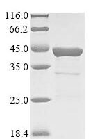 Staphylococcus aureus Beta-lactam-inducible penicillin-binding protein (pbp), partial Recombinant Protein - BioCrest Sci