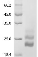Mouse Macrophage colony-stimulating factor 1 (Csf1), partial Recombinant Protein, C-His, aa 33–187, Yeast - BioCrest Sci