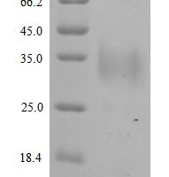 Quercus alba Major pollen allergen Que a 1, partial Recombinant Protein - BioCrest Sci