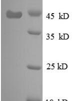 Escherichia coli 30S ribosomal protein S6 (rpsF), partial Recombinant Protein - BioCrest Sci