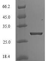 Human ATP-sensitive inward rectifier potassium channel 1 (KCNJ1), partial Recombinant Protein, N-His, aa 178–391, E.coli - BioCrest Sci