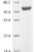 Human Alpha-enolase (ENO1) Recombinant Protein, C-His-Myc, aa 2–434, Purity ≥95% - BioCrest Sci