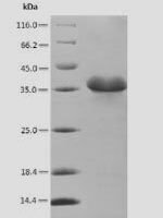Glycine max Cell division cycle protein 48 homolog (CDC48), partial Recombinant Protein - BioCrest Sci