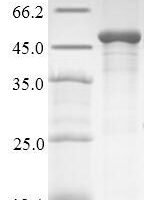 Human HLA class I histocompatibility antigen, alpha chain G (HLA-G),Partial Recombinant Protein - BioCrest Sci