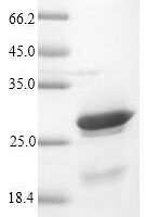 Vaccinia virus Protein K3 (OPG041) Recombinant Protein - BioCrest Sci