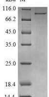 Human ATP-dependent RNA helicase DDX3X (DDX3X) Recombinant Protein, N-His-B2M - BioCrest Sci