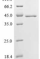 Schistosoma japonicum Glutathione S-transferase class-mu 26 kDa isozyme,Biotinylated Recombinant Protein - BioCrest Sci