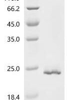 Human Splicing factor, proline- and glutamine-rich (SFPQ), partial Recombinant Protein - BioCrest Sci