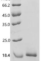 Human Otoancorin (OTOA), partial Recombinant Protein, C-His - BioCrest Sci