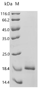 Human Otoancorin (OTOA), partial Recombinant Protein, C-His, Homo sapiens (Human), E.coli, C-terminal 6xHis-tagged, 16.7 kDa, purity >≥ 95% as determined by SDS-PAGE.