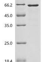 Mouse Mucin-1 (Muc1), partial Recombinant Protein - BioCrest Sci