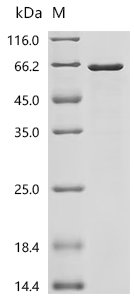 Mouse Mucin-1 (Muc1), partial Recombinant Protein, Mus musculus (Mouse), E.coli, C-terminal 6xHis-tagged, 53.0 kDa, purity >≥ 85% as determined by SDS-PAGE.