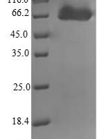 Mycobacterium tuberculosis Putative amidase AmiB2 (amiB2) Recombinant Protein - BioCrest Sci