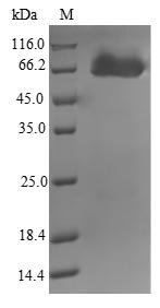 Mycobacterium tuberculosis Putative amidase AmiB2 (amiB2) Recombinant Protein, Mycobacterium tuberculosis (strain ATCC 25618 / H37Rv), E.coli, N-terminal 10xHis-SUMO-tagged and C-terminal Myc-tagged, 69.1 kDa, purity >≥ 90% as determined by SDS-PAGE.
