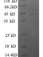 Human General transcription factor IIF subunit 2 (GTF2F2) Recombinant Protein - BioCrest Sci
