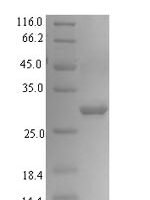 Entamoeba histolytica Calreticulin Recombinant Protein - BioCrest Sci