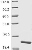 Danio rerio Tumor necrosis factor (TNF superfamily, member 2) (tnfb), partial Recombinant Protein - BioCrest Sci
