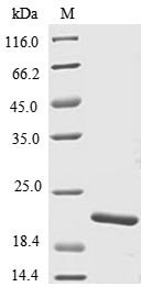 Danio rerio Tumor necrosis factor (TNF superfamily, member 2) (tnfb), partial Recombinant Protein, Danio rerio (Zebrafish) (Brachydanio rerio), E.coli, N-terminal 6xHis-tagged, 19.8 kDa, purity >≥ 85% as determined by SDS-PAGE.