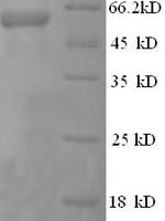 Human Perforin-1 (PRF1) Recombinant Protein - BioCrest Sci