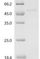 Human Glycogen synthase kinase-3 beta (GSK3B)(D200P) Recombinant Protein - BioCrest Sci