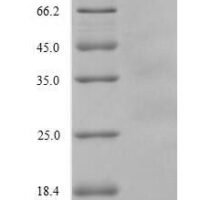 chicken Interleukin-8 (CXCL8), partial Recombinant Protein - BioCrest Sci