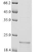 Human G-protein coupled bile acid receptor 1 (GPBAR1), partial Recombinant Protein - BioCrest Sci