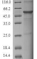 Human Cell death activator CIDE-3 (CIDEC) Recombinant Protein - BioCrest Sci