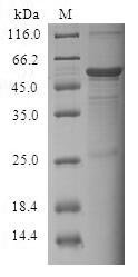 Human Cell death activator CIDE-3 (CIDEC) Recombinant Protein, Homo sapiens (Human), E.coli, N-terminal GST-tagged, 53.8 kDa, purity >≥ 90% as determined by SDS-PAGE.