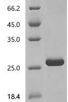 Bothrops jararaca Zinc metalloproteinase-disintegrin-like botrocetin Recombinant Protein - BioCrest Sci
