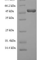 Mouse Hyaluronan synthase 2 (Has2), partial Recombinant Protein, N-His-SUMO - BioCrest Sci