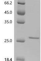 Macaca fascicularis Usherin (USH2A), partial Recombinant Protein - BioCrest Sci