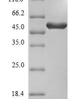 Aspergillus niger 3-phytase A (phyA) Recombinant Protein, N-His - BioCrest Sci
